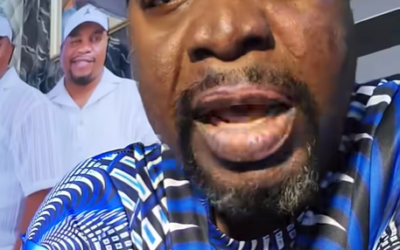 Nigerian singer Kehinde Adegbodu explains injuries caused by home fire accident